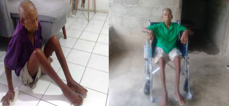 “Ha’u Hetan Ona Kadeira Roda Hosi Ema Laran Osan Mean”