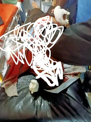 TPNPB Dibawah Komando Numbuk Telenggen Bertanggungjawab Atas Penembakan Anggota Intel di Ilaga Papua